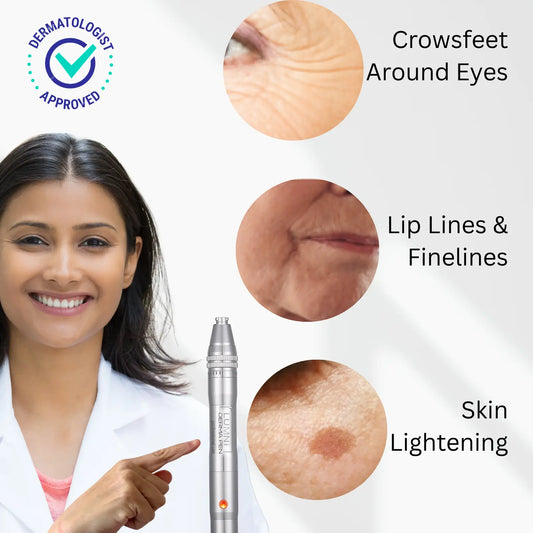 Fade crowsfeet with microneedling pen by Lumni
