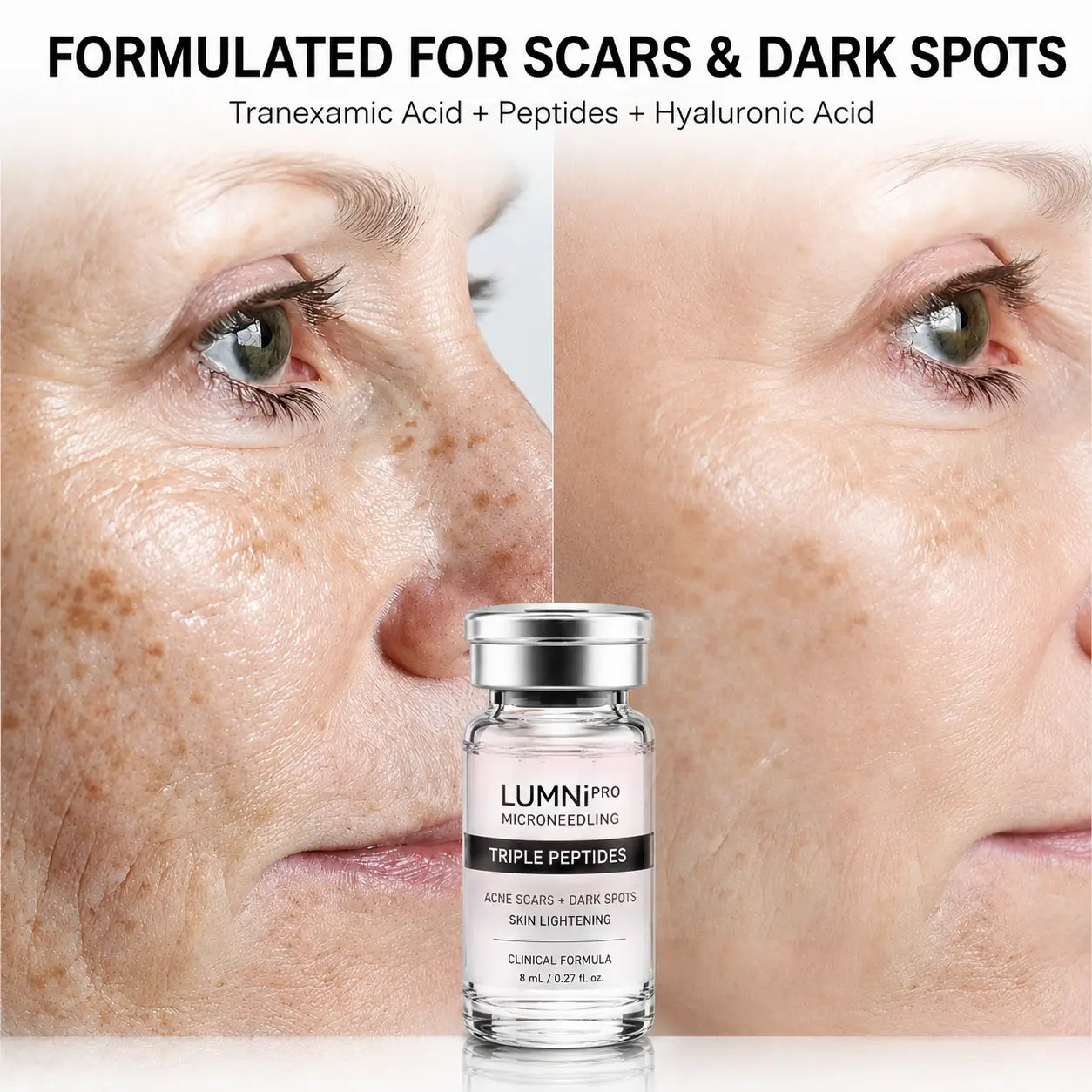 Triple Peptide Microneedling Serum for Acne Scars & Dark Spots