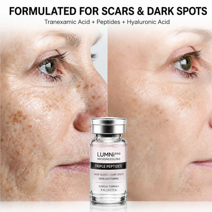 Triple Peptide Microneedling Serum for Acne Scars & Dark Spots